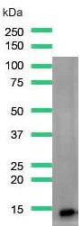 Western blot - Anti-Galectin 1 antibody [SP247] - C-terminal (AB192842)