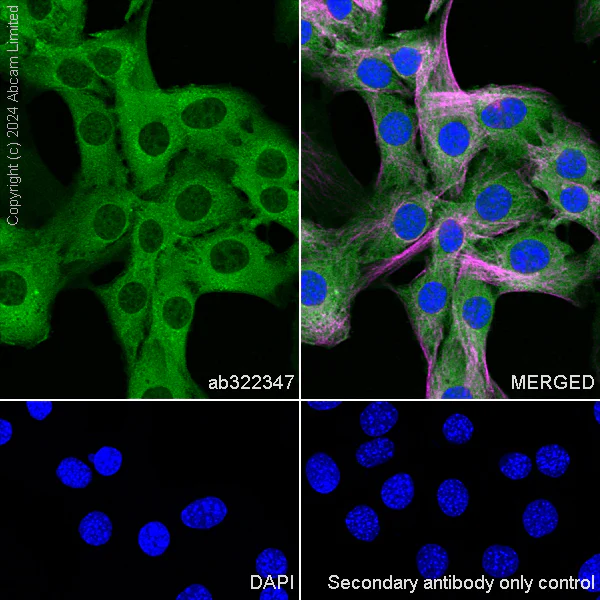 Immunocytochemistry/ Immunofluorescence - Anti-Galectin 1 + Galectin 3 + Galectin 8 antibody [RM1261] (AB322347)