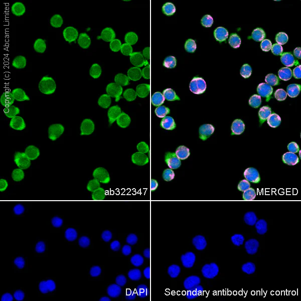 Immunocytochemistry/ Immunofluorescence - Anti-Galectin 1 + Galectin 3 + Galectin 8 antibody [RM1261] (AB322347)