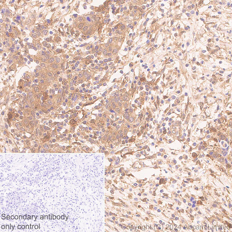 Immunohistochemistry (Formalin/PFA-fixed paraffin-embedded sections) - Anti-Galectin 1 + Galectin 3 + Galectin 8 antibody [RM1261] (AB322347)