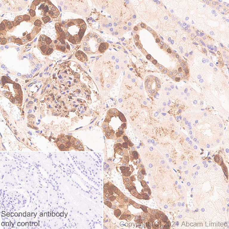 Immunohistochemistry (Formalin/PFA-fixed paraffin-embedded sections) - Anti-Galectin 1 + Galectin 3 + Galectin 8 antibody [RM1261] (AB322347)