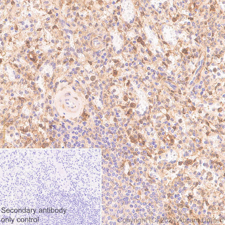 Immunohistochemistry (Formalin/PFA-fixed paraffin-embedded sections) - Anti-Galectin 1 + Galectin 3 + Galectin 8 antibody [RM1261] (AB322347)