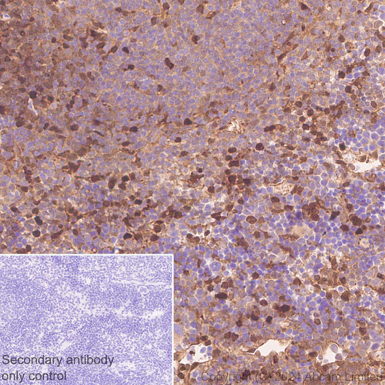 Immunohistochemistry (Formalin/PFA-fixed paraffin-embedded sections) - Anti-Galectin 1 + Galectin 3 + Galectin 8 antibody [RM1261] (AB322347)