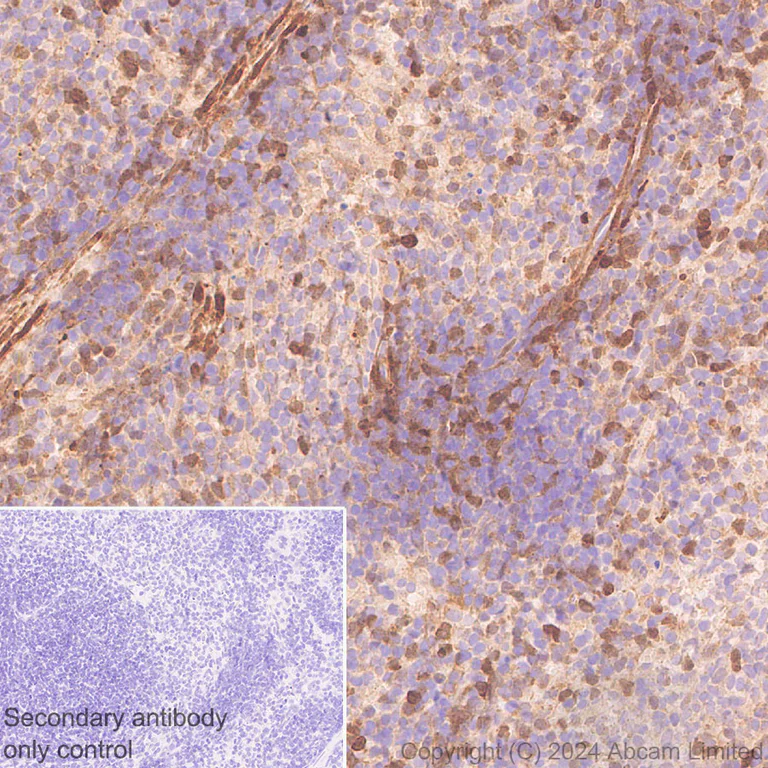 Immunohistochemistry (Formalin/PFA-fixed paraffin-embedded sections) - Anti-Galectin 1 + Galectin 3 + Galectin 8 antibody [RM1261] (AB322347)