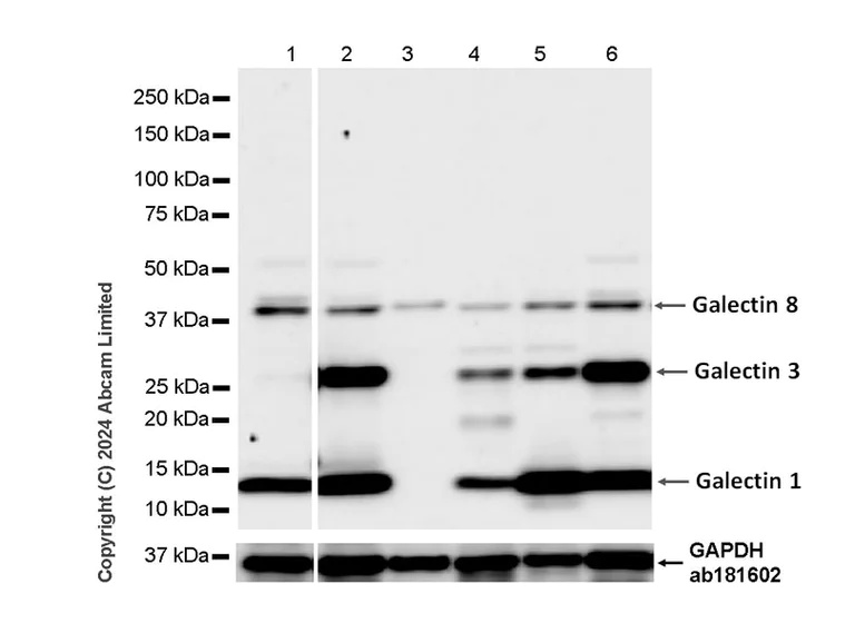 Western blot - Anti-Galectin 1 + Galectin 3 + Galectin 8 antibody [RM1261] (AB322347)