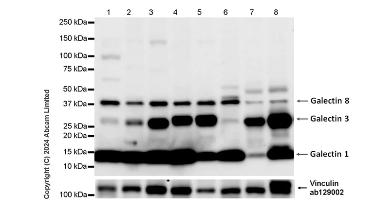 Western blot - Anti-Galectin 1 + Galectin 3 + Galectin 8 antibody [RM1261] (AB322347)