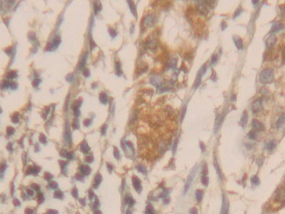 Immunohistochemistry (Formalin/PFA-fixed paraffin-embedded sections) - Anti-Galectin 10 antibody (AB231964), expandable thumbnail