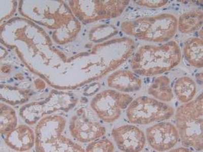 Immunohistochemistry (Formalin/PFA-fixed paraffin-embedded sections) - Anti-Galectin 10 antibody (AB231964), expandable thumbnail