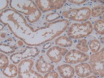 Immunohistochemistry (Formalin/PFA-fixed paraffin-embedded sections) - Anti-Galectin 10 antibody (AB231964)