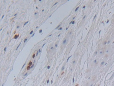Immunohistochemistry (Formalin/PFA-fixed paraffin-embedded sections) - Anti-Galectin 10 antibody (ab231964), expandable thumbnail