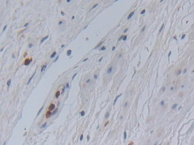 Immunohistochemistry (Formalin/PFA-fixed paraffin-embedded sections) - Anti-Galectin 10 antibody (AB231964)