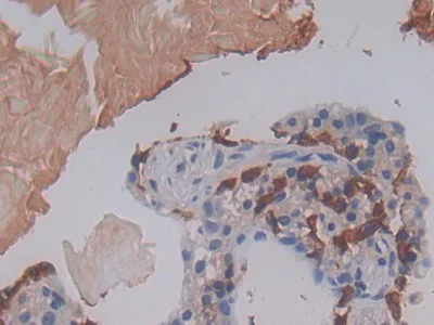 Immunohistochemistry (Formalin/PFA-fixed paraffin-embedded sections) - Anti-Galectin 10 antibody (AB231964)
