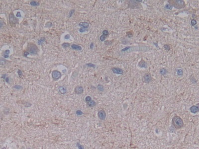 Immunohistochemistry (Formalin/PFA-fixed paraffin-embedded sections) - Anti-Galectin 10 antibody (ab231964), expandable thumbnail