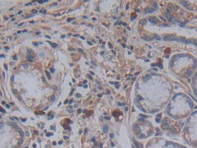 Immunohistochemistry (Formalin/PFA-fixed paraffin-embedded sections) - Anti-Galectin 10 antibody (AB231964), expandable thumbnail