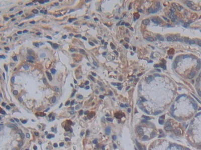 Immunohistochemistry (Formalin/PFA-fixed paraffin-embedded sections) - Anti-Galectin 10 antibody (AB231964)