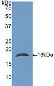 Western blot - Anti-Galectin 10 antibody (AB231964), expandable thumbnail