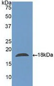 Western blot - Anti-Galectin 10 antibody (AB231964)