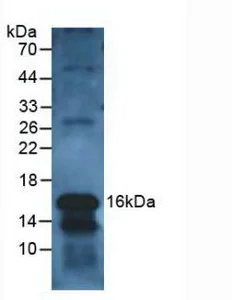 Western blot - Anti-Galectin 10 antibody (AB231964)