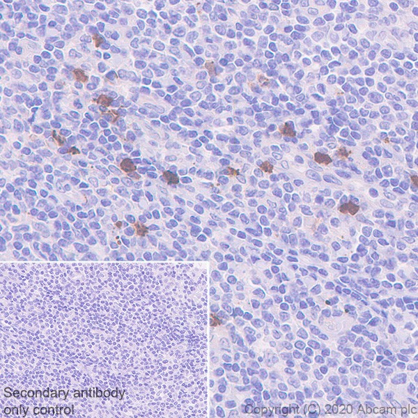Immunohistochemistry (Formalin/PFA-fixed paraffin-embedded sections) - Anti-Galectin 10 antibody [EPR11197] (AB157475)
