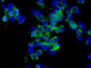 Immunocytochemistry/ Immunofluorescence - Anti-Galectin 10 antibody [EPR11197] - BSA and Azide free (AB249338)