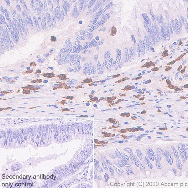 Immunohistochemistry (Formalin/PFA-fixed paraffin-embedded sections) - Anti-Galectin 10 antibody [EPR11197] - BSA and Azide free (AB249338)