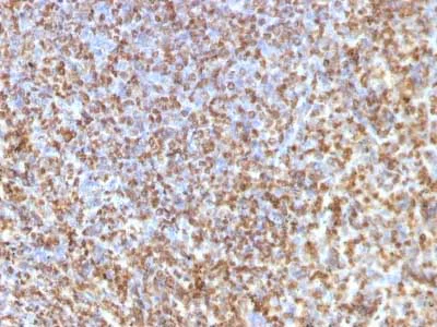 Immunohistochemistry (Formalin/PFA-fixed paraffin-embedded sections) - Anti-Galectin 13/PLAC8 antibody [PP13/1161] (AB218411)