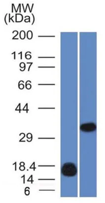 Western blot - Anti-Galectin 13/PLAC8 antibody [PP13/1161] (AB218411)