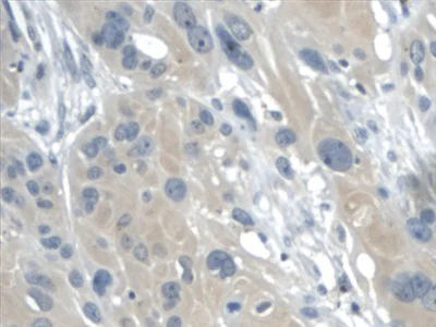 Immunohistochemistry (Formalin/PFA-fixed paraffin-embedded sections) - Anti-Galectin 2 antibody [C6] (AB239501)