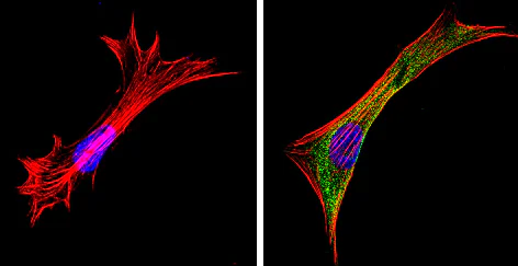Immunocytochemistry/ Immunofluorescence - Anti-Galectin 3 antibody [A3A12] (AB2785)