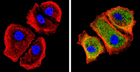 Immunocytochemistry/ Immunofluorescence - Anti-Galectin 3 antibody [A3A12] (AB2785)
