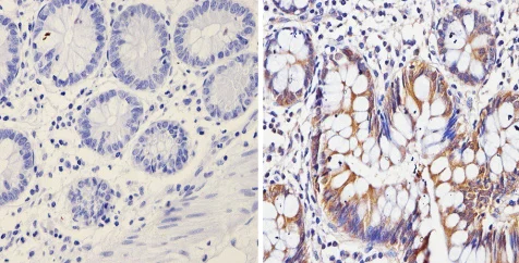 Immunohistochemistry (Formalin/PFA-fixed paraffin-embedded sections) - Anti-Galectin 3 antibody [A3A12] (AB2785)