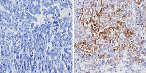 Immunohistochemistry (Formalin/PFA-fixed paraffin-embedded sections) - Anti-Galectin 3 antibody [A3A12] (AB2785)