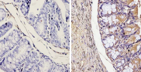 Immunohistochemistry (Formalin/PFA-fixed paraffin-embedded sections) - Anti-Galectin 3 antibody [A3A12] (AB2785)