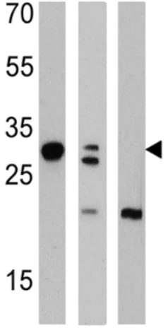 Western blot - Anti-Galectin 3 antibody [A3A12] (AB2785)