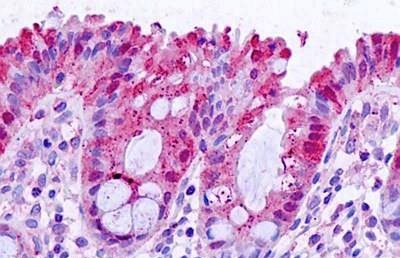 Immunohistochemistry (Formalin/PFA-fixed paraffin-embedded sections) - Anti-Galectin 3 antibody (AB190167)