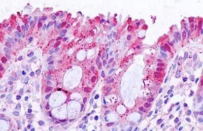 Immunohistochemistry (Formalin/PFA-fixed paraffin-embedded sections) - Anti-Galectin 3 antibody (AB190167)