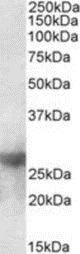 Western blot - Anti-Galectin 3 antibody (AB190167)