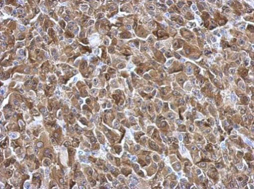 Immunohistochemistry (Formalin/PFA-fixed paraffin-embedded sections) - Anti-Galectin 3 antibody (AB227249)