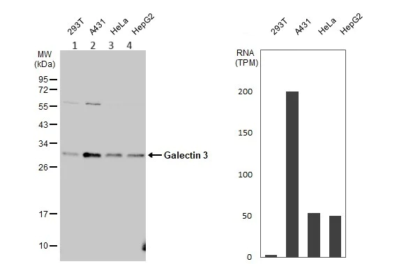 Western blot - Anti-Galectin 3 antibody (AB227249)