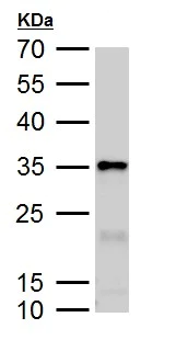 Western blot - Anti-Galectin 3 antibody (AB227249)