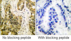 Immunohistochemistry (Formalin/PFA-fixed paraffin-embedded sections) - Anti-Galectin 3 antibody (AB53082)