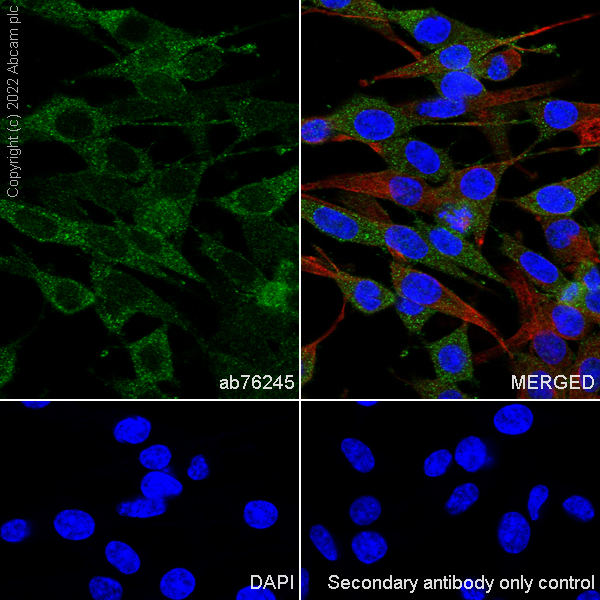 Immunocytochemistry/ Immunofluorescence - Anti-Galectin 3 antibody [EP2775Y] - BSA and Azide free (ab197544), expandable thumbnail