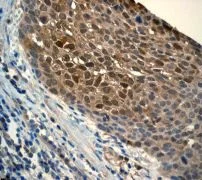 Immunohistochemistry (Formalin/PFA-fixed paraffin-embedded sections) - Anti-Galectin 3 antibody [EP2775Y] - BSA and Azide free (AB197544)