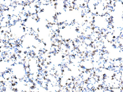 Immunohistochemistry (Formalin/PFA-fixed paraffin-embedded sections) - Anti-Galectin 3 antibody [EP2775Y] - BSA and Azide free (AB197544), expandable thumbnail