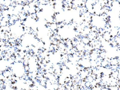Immunohistochemistry (Formalin/PFA-fixed paraffin-embedded sections) - Anti-Galectin 3 antibody [EP2775Y] - BSA and Azide free (AB197544)