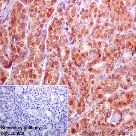 Immunohistochemistry (Formalin/PFA-fixed paraffin-embedded sections) - Anti-Galectin 3 antibody [EP2775Y] - BSA and Azide free (AB197544)