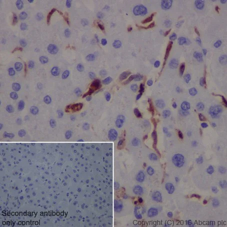 Immunohistochemistry (Formalin/PFA-fixed paraffin-embedded sections) - Anti-Galectin 3 antibody [EPR19244] - BSA and Azide free (AB251504)