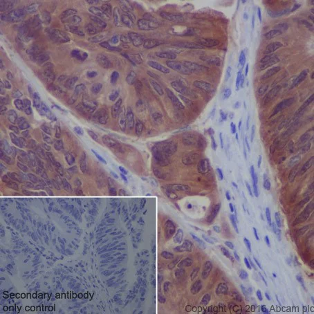 Immunohistochemistry (Formalin/PFA-fixed paraffin-embedded sections) - Anti-Galectin 3 antibody [EPR19244] - BSA and Azide free (AB251504)