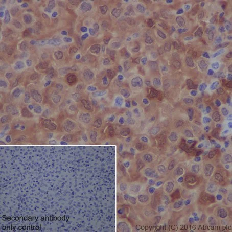 Immunohistochemistry (Formalin/PFA-fixed paraffin-embedded sections) - Anti-Galectin 3 antibody [EPR19244] - BSA and Azide free (AB251504)