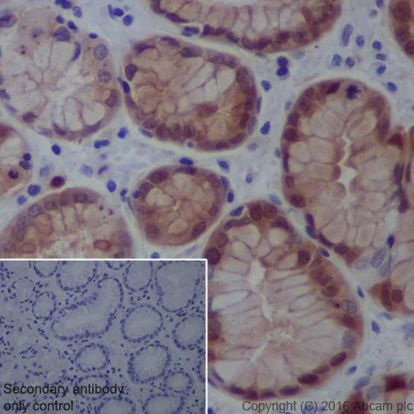 Immunohistochemistry (Formalin/PFA-fixed paraffin-embedded sections) - Anti-Galectin 3 antibody [EPR19244] - BSA and Azide free (AB251504)
